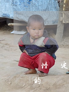 傷情鑒定只看病歷嗎(傷情鑒定醫(yī)生的診斷證明重要嗎)