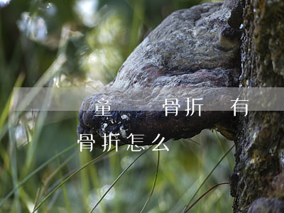 兒童車禍骨折沒有傷殘能賠多少錢(車禍沒有骨折怎么賠償)