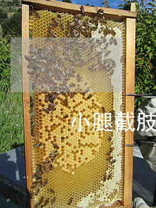 小腿截肢賠償案例(雙腿截肢賠償100萬)