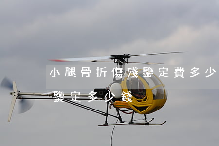 小腿骨折傷殘鑒定費多少錢合肥(骨折做傷殘鑒定多少錢)