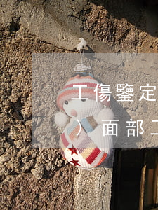工傷鑒定賠償標(biāo)準(zhǔn)(面部工傷鑒定賠償標(biāo)準(zhǔn))