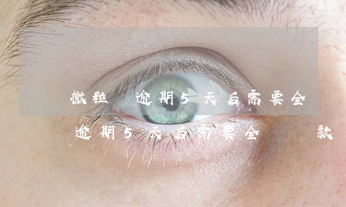 微粒貸逾期5天后需要全額還款嗎-微粒貸逾期5天后需要全額還款嗎怎么辦