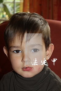 法定甲類傳染病