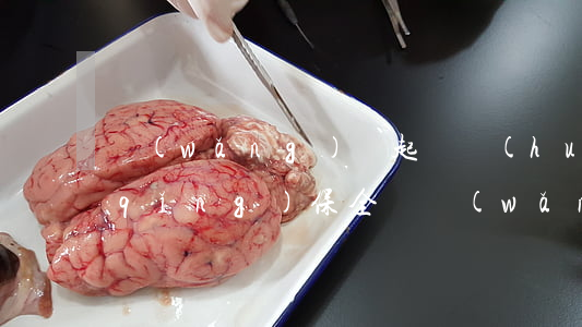 網(wǎng)貸起訴會(huì)申請(qǐng)保全嗎 網(wǎng)貸起訴申請(qǐng)法院財(cái)產(chǎn)保全