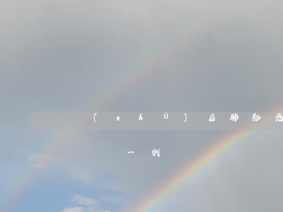術(shù)后肺部感染致死醫(yī)療糾紛一例