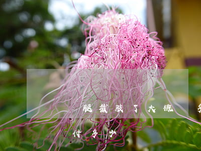 車禍腿截肢了大概賠多少(工傷右腿截肢大概賠付多少錢)