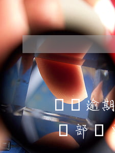 還唄逾期總部說要取消分期怎么辦(還唄逾期總部說要取消分期怎么辦呀)