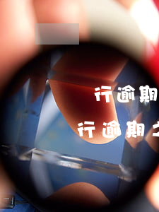 銀行逾期還不上怎么協(xié)商 那個銀行逾期之后最難協(xié)商