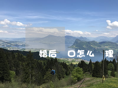 離婚后戶口怎么處理(離婚后戶口怎么處理)