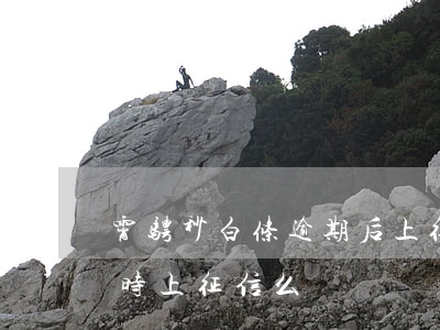 霄骋秒白条逾期后上征信吗 白条逾期一个小时上征信么
