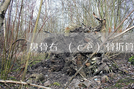 鼻骨右側(cè)骨折算輕傷嗎