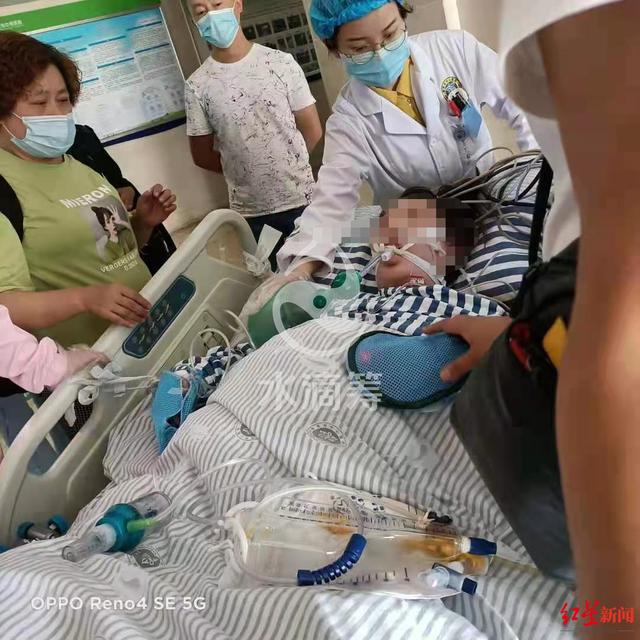 交通事故腿受伤后又形成了血栓(刚剖腹产生下儿子，妻子左腿又因血栓被截肢 丈夫无奈网上求助)