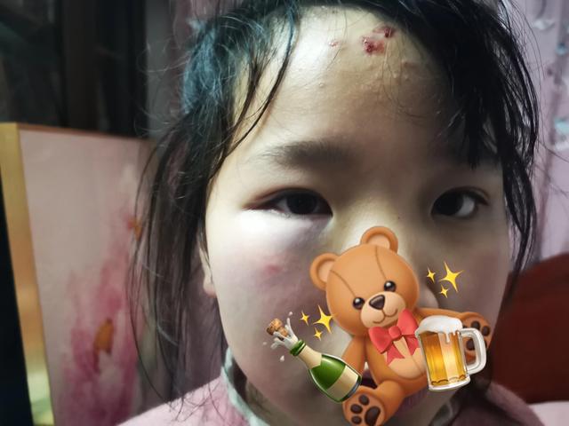 头被撞拍片子多少钱(女儿在学校被撞得鼻青脸肿，撞人孩子的家长却问我要保险单号)